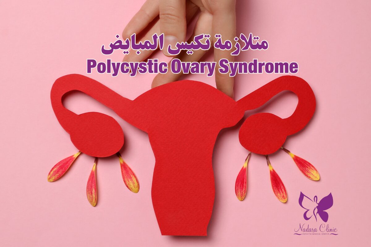 متلازمة تكيس المبايض في الغردقة